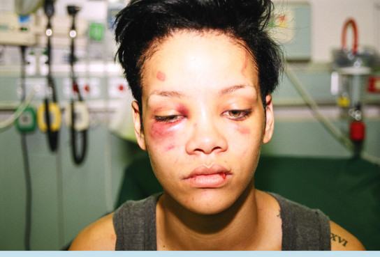 rihanna-vs-amy-lee_468193